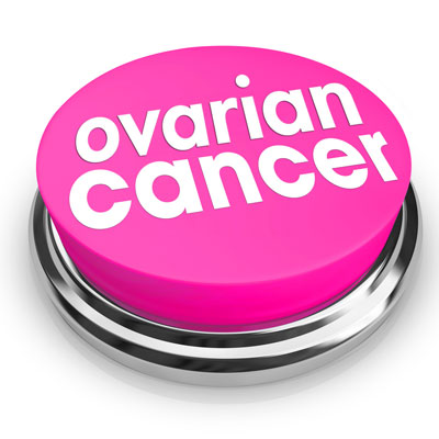 Ovarian cancer: the silent killer