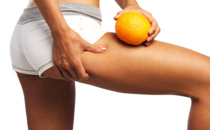 The truth about cellulite