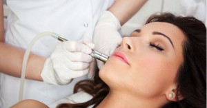 Microdermabrasion