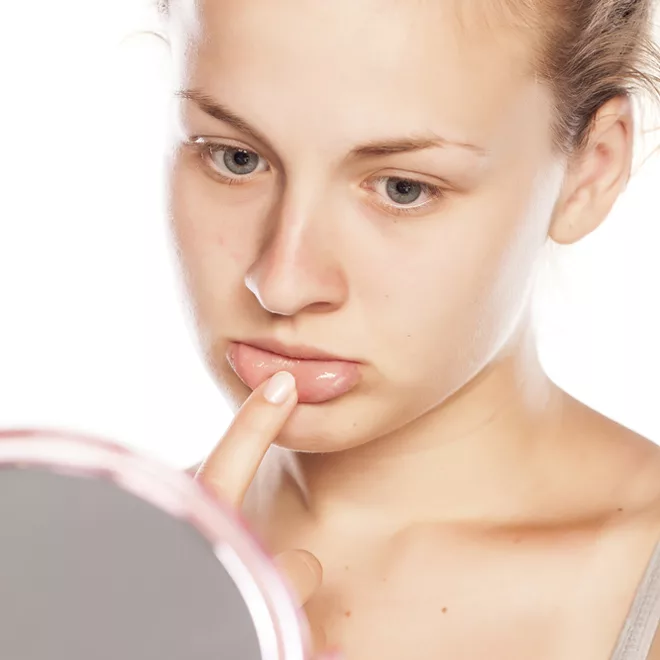 The skin around my mouth is dry and cracked, help! - Beauty South Africa