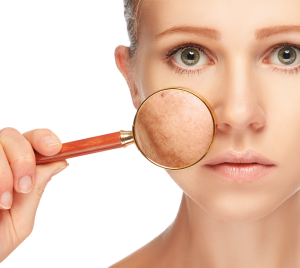 can-laser-give-pigmentation