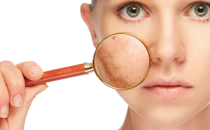 Can laser treatments give me pigmentation?