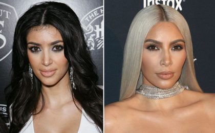 Kardashian-Jenner beauty: Then and now