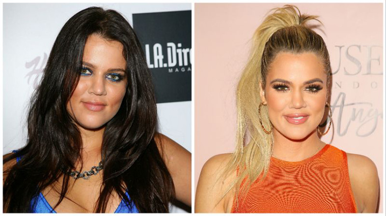 Kardashian-Jenner beauty: Then and now 5