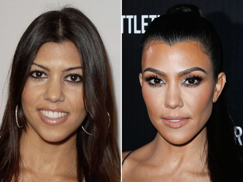 Kardashian-Jenner beauty: Then and now 6