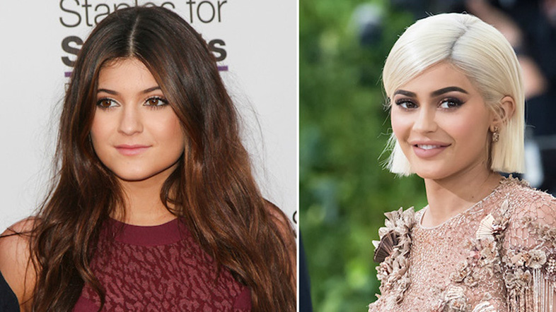 Kardashian-Jenner beauty: Then and now 9