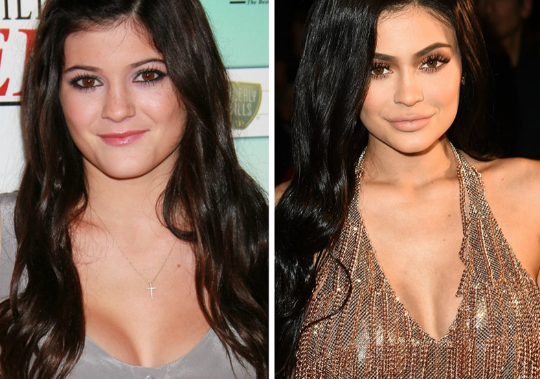 Kardashian-Jenner beauty: Then and now 11