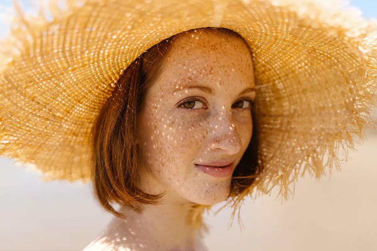 woman in the sun with hyperpigmentation